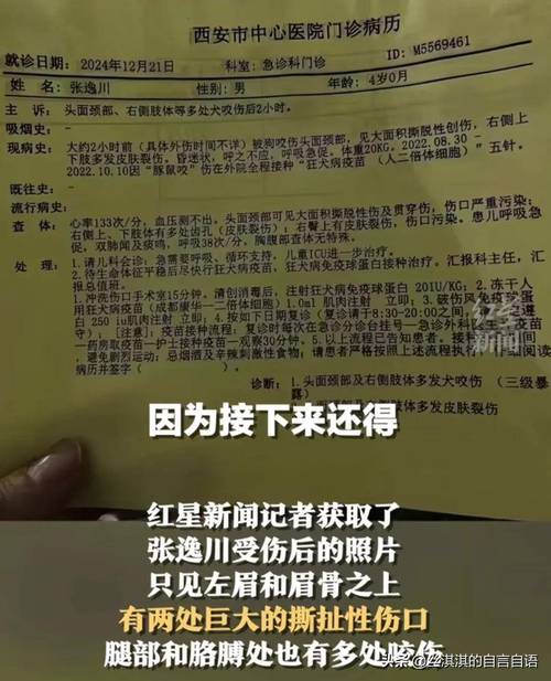 澳彩77749.cσm查询开奖和7岁男孩遭3只犬撕咬与7岁男孩遭3只犬撕咬怎么办