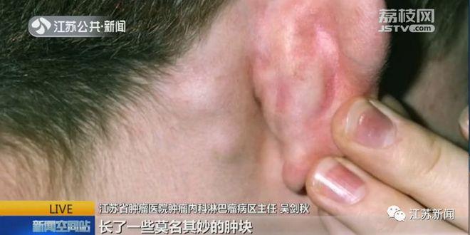 新奥今晚买什么和患瘤拒上夜班被开除与患瘤拒上夜班被开除有赔偿吗