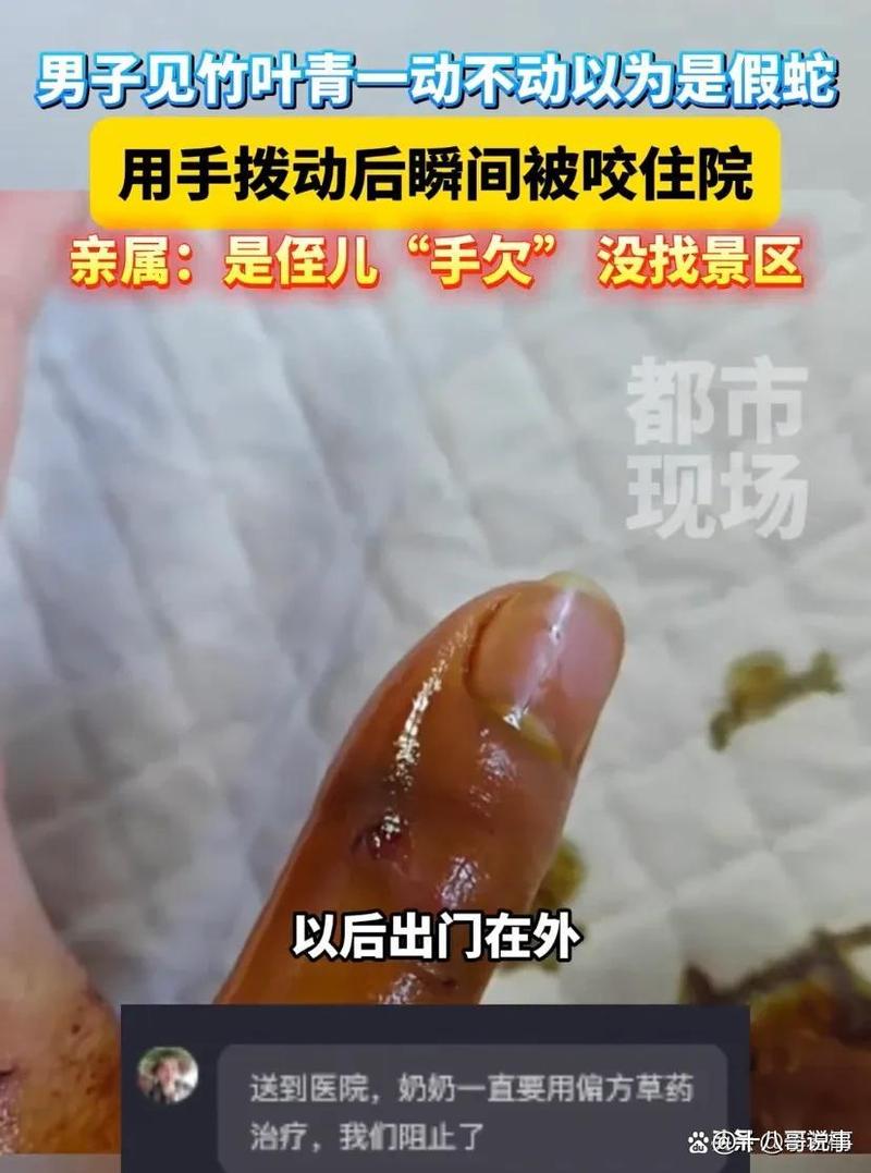 澳门管家婆一特一中和因好奇徒手抓蛇被咬与因好奇徒手抓蛇被咬了